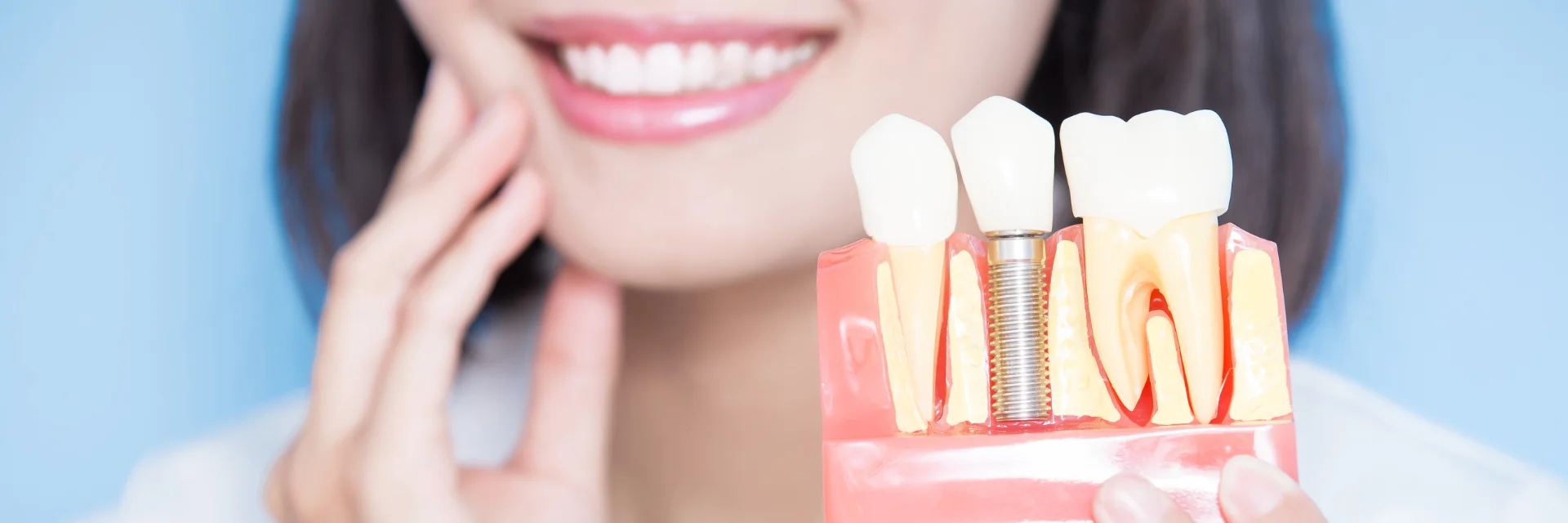 Ein Zahnarzt demonstriert hochwertige Zahnimplantate mit modernen Methoden für dauerhaften Zahnersatz